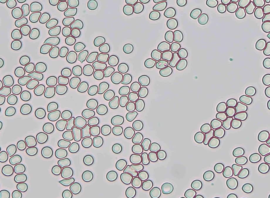 Babesioza la câini: o boală transmisă de căpușe care pune viața în pericol
